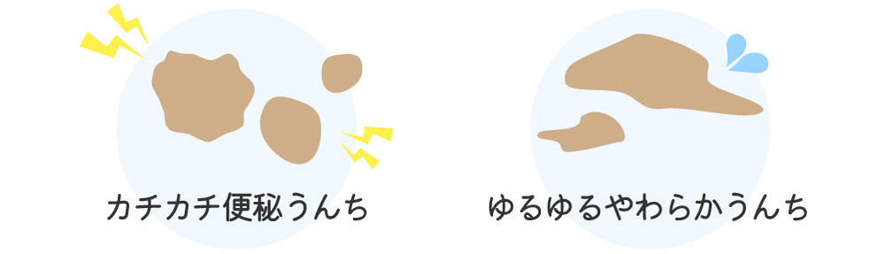 カチカチ便秘うんち、ゆるゆるやわらかうんち